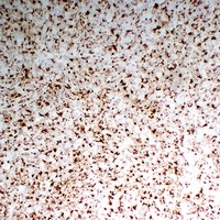 CD68 Mouse Monoclonal Antibody