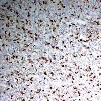 CD68 Mouse Monoclonal Antibody