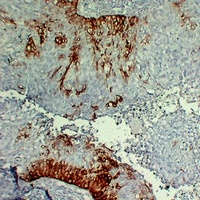 Cytokeratin 15 Mouse Monoclonal Antibody