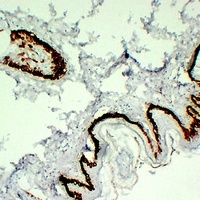 Cytokeratin 15 Mouse Monoclonal Antibody