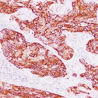 Cytokeratin 15 Mouse Monoclonal Antibody