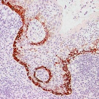 Cytokeratin 15 Mouse Monoclonal Antibody