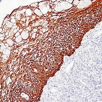 Cytokeratin 5/6 Mouse Monoclonal Antibody