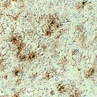 GFAP Mouse Monoclonal Antibody