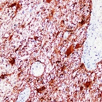 GFAP Mouse Monoclonal Antibody