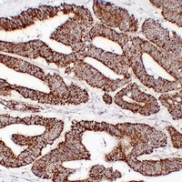 HSP60 Mouse Monoclonal Antibody