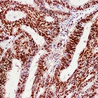 PCNA Mouse Monoclonal Antibody