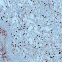 CD14 Mouse Monoclonal Antibody