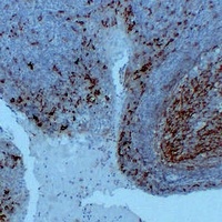 CD14 Mouse Monoclonal Antibody