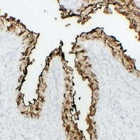 Uroplakin 3a Mouse Monoclonal Antibody