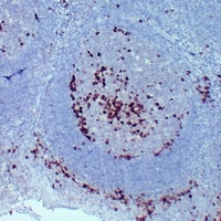 CD38 Mouse Monoclonal Antibody