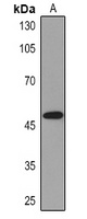 Cytokeratin 13 Mouse Monoclonal Antibody