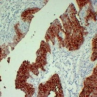 Cytokeratin 13 Mouse Monoclonal Antibody