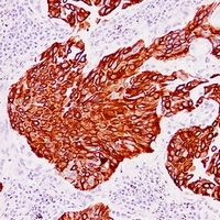 Cytokeratin 13 Mouse Monoclonal Antibody