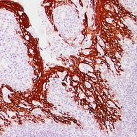Cytokeratin 13 Mouse Monoclonal Antibody