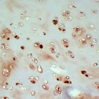 Collagen 2 alpha 1 Mouse Monoclonal Antibody