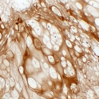 Collagen 2 alpha 1 Mouse Monoclonal Antibody
