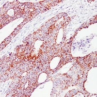HSP60 Mouse Monoclonal Antibody