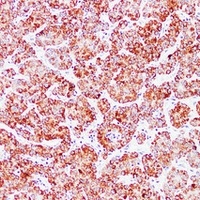 HSP60 Mouse Monoclonal Antibody