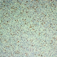 Ki67 Mouse Monoclonal Antibody