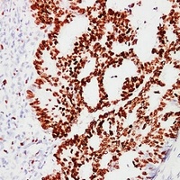 Ki67 Mouse Monoclonal Antibody