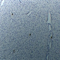 TPSAB1 Mouse Monoclonal Antibody
