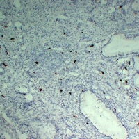 TPSAB1 Mouse Monoclonal Antibody