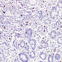 TPSAB1 Mouse Monoclonal Antibody