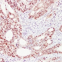PCNA Mouse Monoclonal Antibody