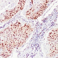 PCNA Mouse Monoclonal Antibody