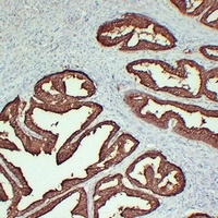 TMPase Mouse Monoclonal Antibody