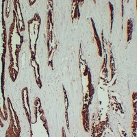 TMPase Mouse Monoclonal Antibody