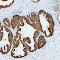 TMPase Mouse Monoclonal Antibody