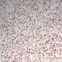 CD68 Mouse Monoclonal Antibody