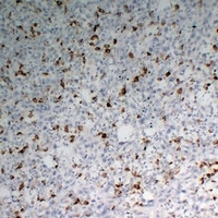 CD68 Mouse Monoclonal Antibody