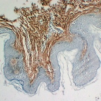 Collagen 3 alpha 1 Mouse Monoclonal Antibody