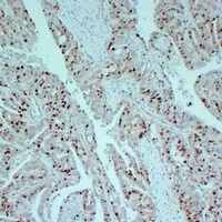Topoisomerase 2 alpha Mouse Monoclonal Antibody