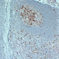 Topoisomerase 2 alpha Mouse Monoclonal Antibody