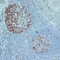 Topoisomerase 2 alpha Mouse Monoclonal Antibody