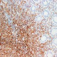 CD20 Mouse Monoclonal Antibody