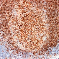 CD20 Mouse Monoclonal Antibody