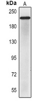 CD56 Mouse Monoclonal Antibody