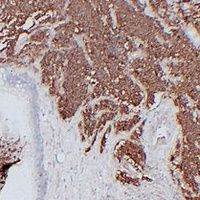 CD56 Mouse Monoclonal Antibody