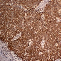 Cytokeratin 5 Mouse Monoclonal Antibody