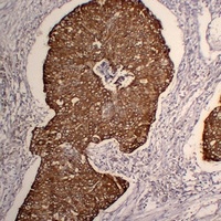 Cytokeratin 5 Mouse Monoclonal Antibody