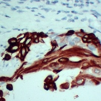 Cytokeratin 5 Mouse Monoclonal Antibody