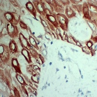 Cytokeratin 5 Mouse Monoclonal Antibody