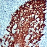 Cytokeratin 5 Mouse Monoclonal Antibody