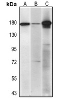 Topoisomerase 2 alpha Mouse Monoclonal Antibody