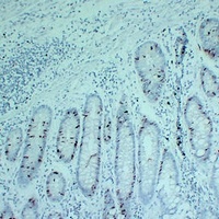 Topoisomerase 2 alpha Mouse Monoclonal Antibody